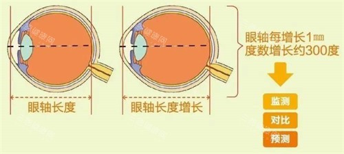 南昌一附院和二附院眼科哪个好？避开排队烦恼！两大眼科门诊时间、交通路线及预约技巧全览！