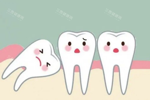 种植牙旁边的智齿需要拔出吗?智齿歪斜/发炎/顶邻牙必须拔,否则种植体恐松动!
