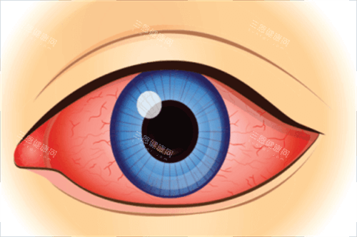 西安第四医院眼科收费价格一览！近视矫正9800元起，白内障6500元起，OK镜5500元起！！