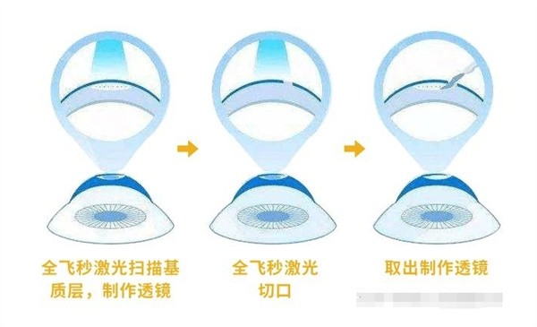 青岛眼科北部院区预约挂号全攻略：电话、地址、放号时间一次告诉你，2025年新信息速看！