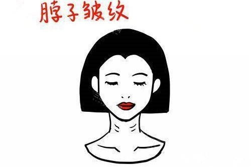 脖子皱纹卡通图