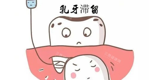 乳牙滞留坏处