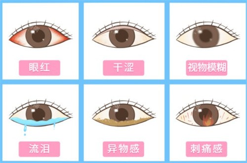 干眼症症状