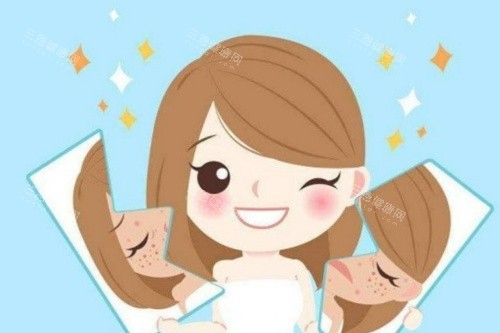 激光祛斑前后对比展示图