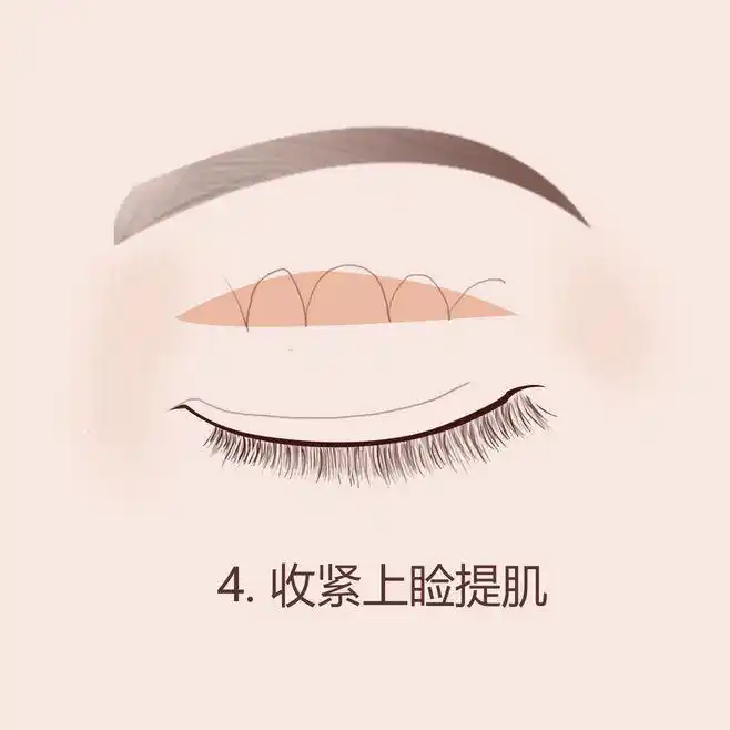 眼睑下垂矫正