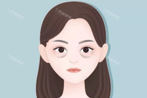 眼袋卡通图展示