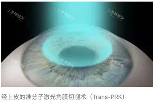 香港大学深圳医院眼科 2025 价格表查询：近视矫正10700元起、白内障6800元起、斜视6000元起