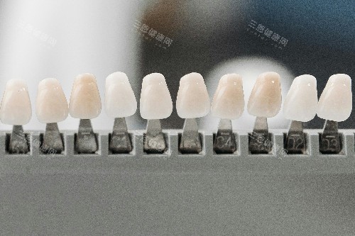 牙齿贴面色号