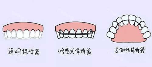 大理牙洁士口腔怎么样？连锁资质正规|设备新，做种植牙、正畸都擅长备受市民好评