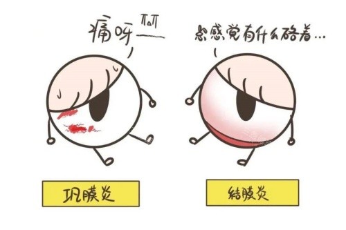 巩膜炎与结膜炎卡通对比