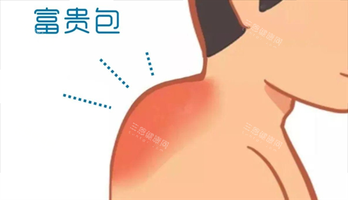 富贵包动画展示