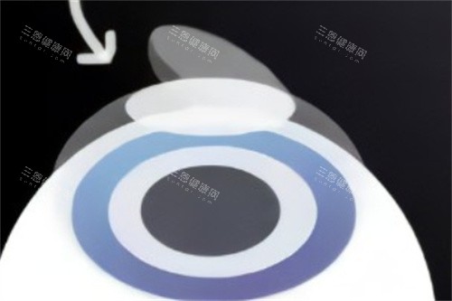 河源哪些医院能做白内障手术？爱尔眼科、光明眼科、龙川康明眼科3家优质机构值得选