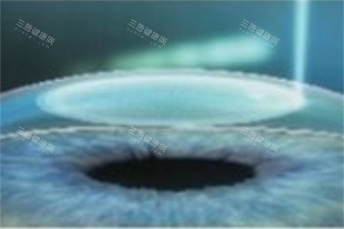 岳阳爱尔眼科医院怎么样？是正规医院吗？附口碑与预约挂号方式