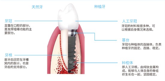 2025马鞍山牙科价格表查询，种牙|正畸|根管治疗|补牙及镶牙项目费用参考
