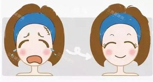 成都润美晶肤激光美容前后对比卡通示意图