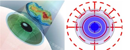西安佰视佳眼科到底可不可信？真实可信且为正规私立眼科，实力与信誉并存