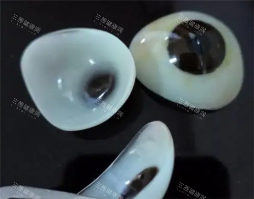 梅州爱尔眼科有做义眼的吗？当然有！定制义眼逼真到以假乱真，还能跟着真眼转动！