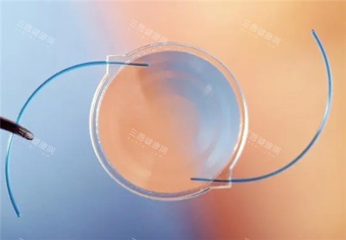 2025长春医大二院眼科白内障手术价目更新：超声乳化8000+人工晶体5800+多品牌价格一览