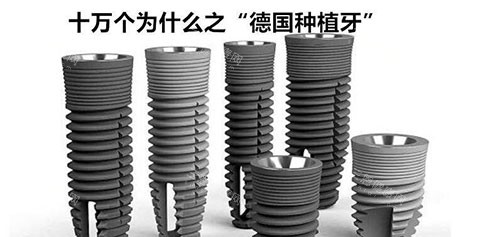 德国种植牙示意图