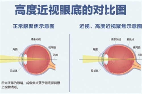 沈阳盛京眼科好还是四院眼科好？各项优势大揭秘，深度对比从医师团队到服务谁能脱颖而出？