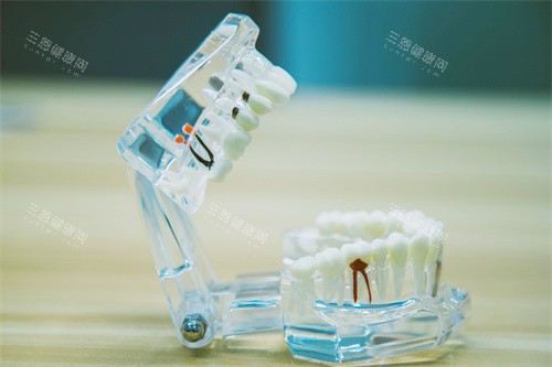 线上看牙太方便！24小时免费问诊通道已开放，口腔问题随时询问不花钱，医生在线答疑！