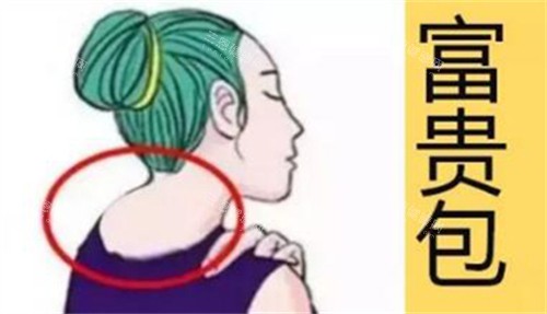 盐城富贵包手术哪家医院好？医师推荐这几家，术后结果和价格对比！