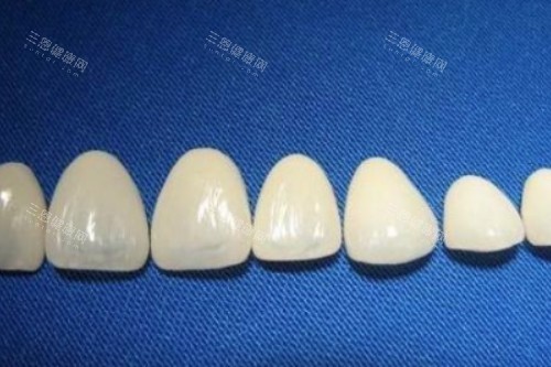 烤瓷牙冠卡通展示图