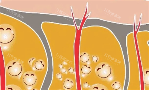脂肪透视形象展示图