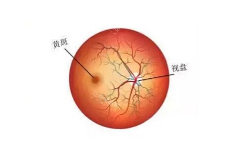 法瑞西单抗治疗黄斑变性图片展示