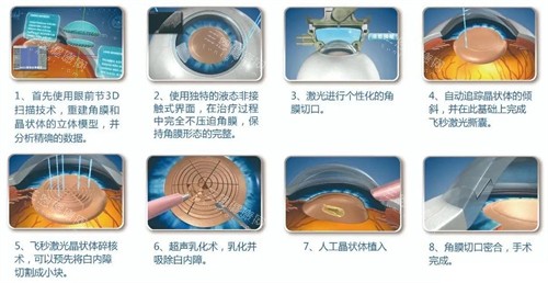 沈阳四院眼科网上挂号指南！微信预约/电话挂号/在线取号全流程图文教程！