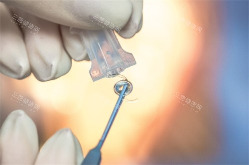 蔡司809m双焦和强生icb00单焦哪个好？考虑经济成本，单焦性价比高；看重功能，双焦能兼顾远近视力