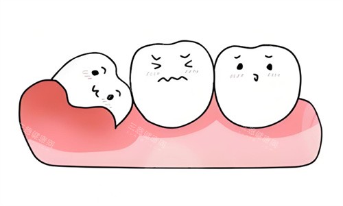 智齿卡通图片