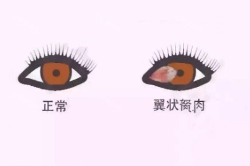 爱尔眼科预约挂号超全指南：一键预约/电话挂号/网上挂号及线下挂号方式大公开！