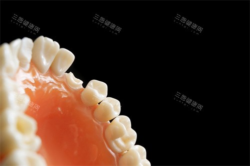 牙齿修复图示