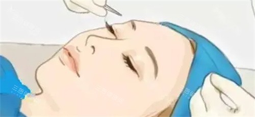 杜园园做眼睛怎么样？专攻眼修复，以“解剖与美学并重”实现持久自然美眼结果