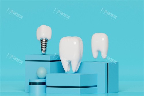 中山一院牙科收费表！种植5600元起，矫正6999元起，补牙洗牙价清晰