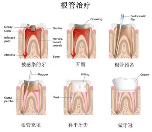 蚌埠医学院第一附属医院口腔科怎么样？长淮路有院址，拔牙矫正等项目价格清晰
