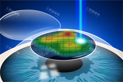 银川西门桥眼科医院电话是多少？0951-5029预约，周六日照常接诊，解放西路429号别跑错！