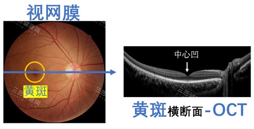 云大眼科袁玲口碑评价怎么样？黄斑裂孔手术98%左右成功几率|患者:耐心细致!