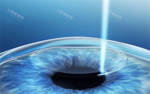 海南省眼科医院医生排名新鲜出炉：曾明兵、李树南、陈海波技术高超医生强势上榜，就医选医有参考​