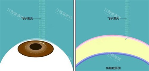 江阴光明眼科医院真实评价大揭秘：医院简介、患者口碑、详细地址、挂号指南超全解析，就医不踩坑​