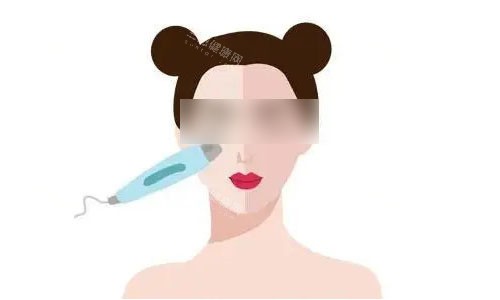 光子嫩肤流程图