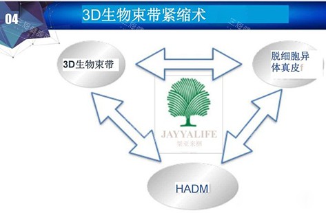 3d生物束带紧缩术讲解示意图