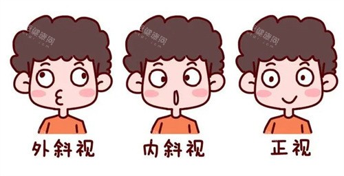 一只眼睛废用性斜视怎么办？深入解析废用性斜视的成因与矫正方案，复视、眼位偏斜这样改善！