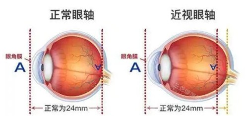 济南新视界眼科手术价格大公开，近视手术 7800 元起，白内障 8800 元起，斜视矫正 6300 元起