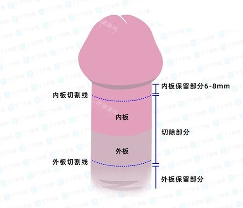 从增粗到勃起改善，韩国男科医院怎么选？这5家用户评价藏不住了！~