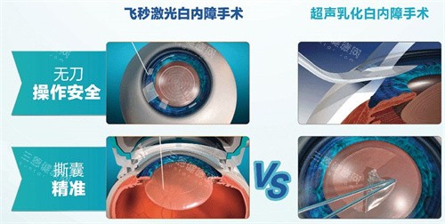 白内障扶持政策有哪些？2025年全新惠民项目详解，帮困难家庭减轻负担！