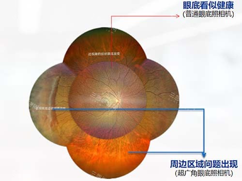 惠州爱尔眼科医院杜云医师简介：专攻眼底诊疗_视网膜外路手术8000元左右_惠城区斑樟湖二横街可约！