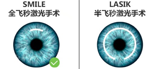 厦门大学附属第一医院眼科电话号码，网上预约挂号，到院预约服务分享！