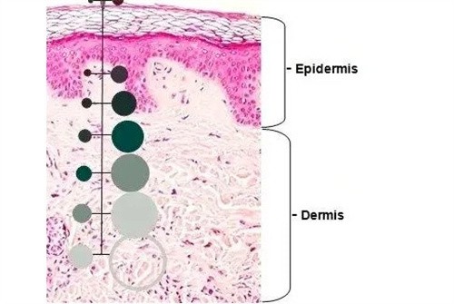 皮秒去纹身 皮秒去纹身